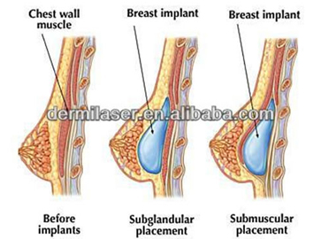 treatment_pic