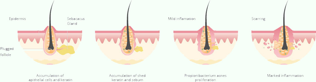 treatment_pic